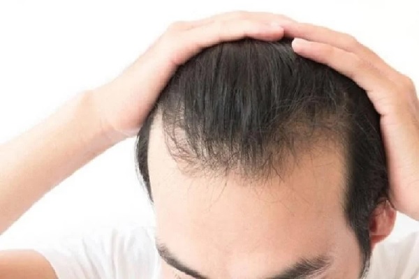 Dầu gội cho nam tóc mỏng chống rụng tóc hiệu quả  Gatinovn